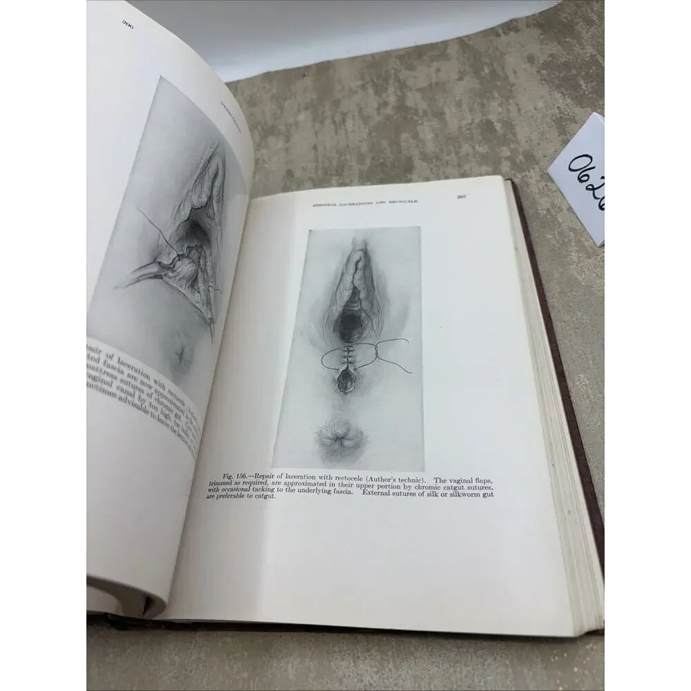 TEXTBOOK OF GYNECOLOGY 2nd Edition of 1931 By Arthur Hale Curtis